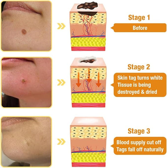 Bee Venom Skin Treatment Cream,Repair Maximum Strength for All Skin Types (1PCS)