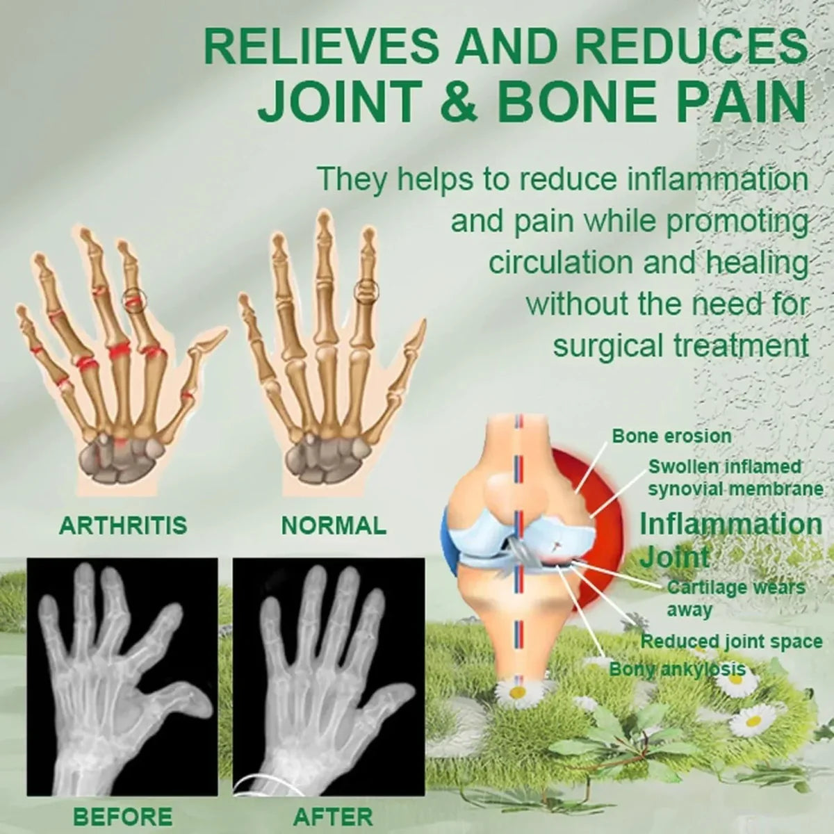 Bee Venom Bone and Joint Therapy Cream - (Buy 1 get 1 Free🔥)