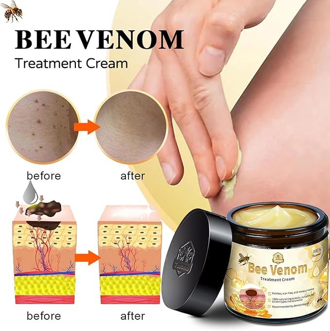 Bee Venom Skin Treatment Cream,Repair Maximum Strength for All Skin Types (1PCS)