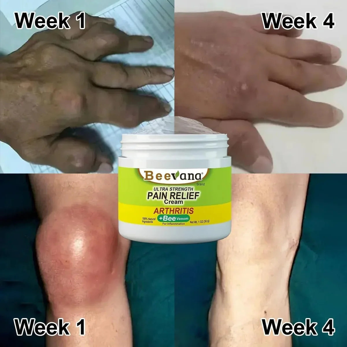 Bee Venom Bone and Joint Therapy Cream - (Buy 1 get 1 Free🔥)